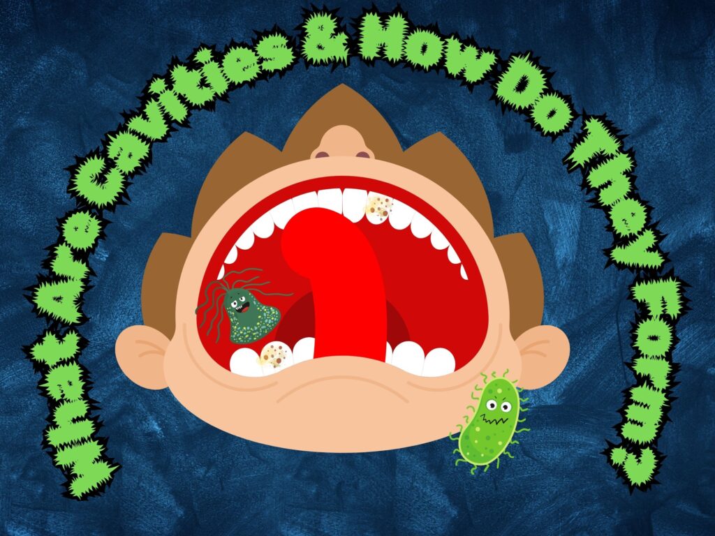 what are cavities and how do they form?